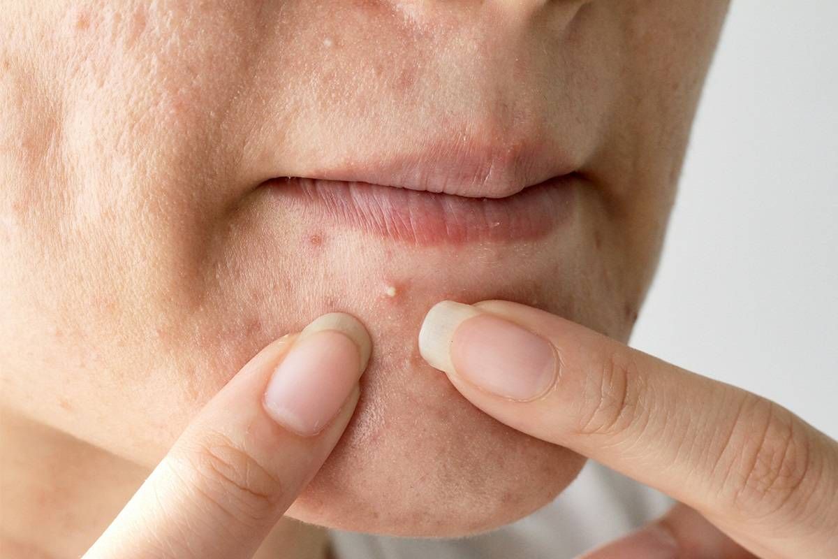 سلولهای چربی