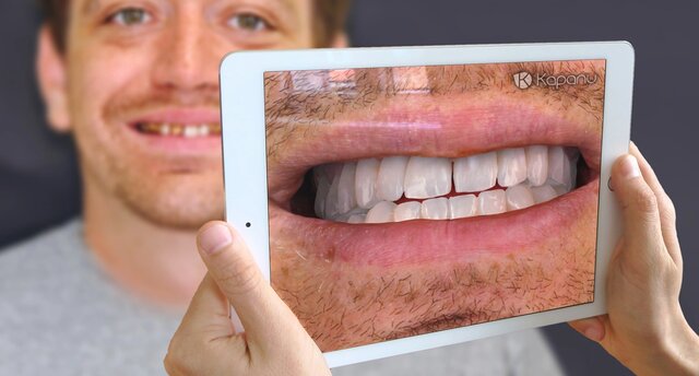 فناوری‌هایی که دندانپزشکی را در سال ۲۰۲۲ دستخوش تغییر می‌کنند
