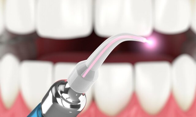 فناوری‌هایی که دندانپزشکی را در سال ۲۰۲۲ دستخوش تغییر می‌کنند