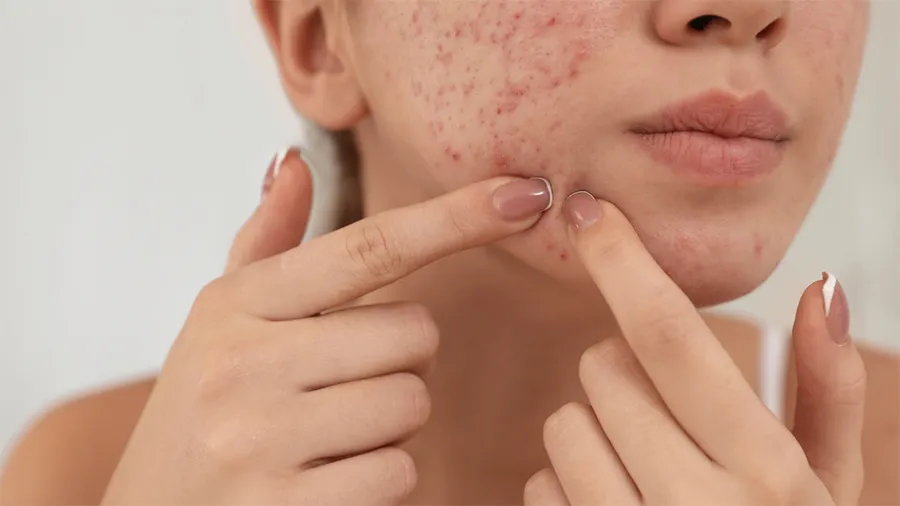 آیا خودارضایی باعث مشکلاتی مثل جوش صورت، ریزش مو یا تغییر ظاهر اندام تناسلی می‌شود؟