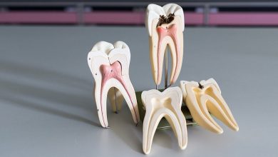 درمان ریشه دندان